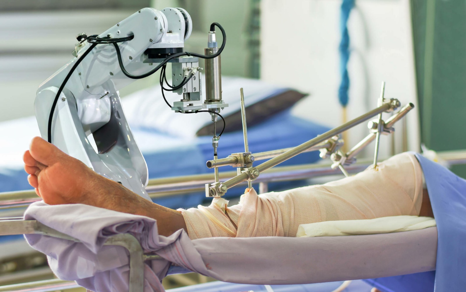 Robotic Knee Replacement Robotic Knee Replacement