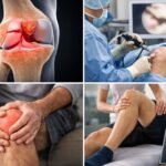 Arthroscopic meniscus tear surgery and knee injury treatment showing torn meniscus, knee locking pain, and rehabilitation therapy