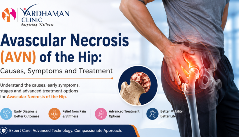 Avascular necrosis (AVN) of the hip showing hip pain, bone damage, causes, symptoms, diagnosis, stages, and treatment options including hip replacement surgery.