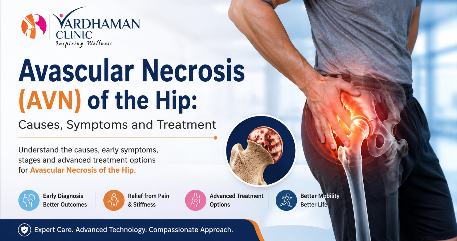 Avascular necrosis (AVN) of the hip showing hip pain, bone damage, causes, symptoms, diagnosis, stages, and treatment options including hip replacement surgery.