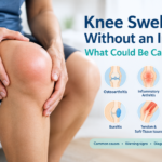 Swollen knee without injury showing common causes such as arthritis, gout, and bursitis.